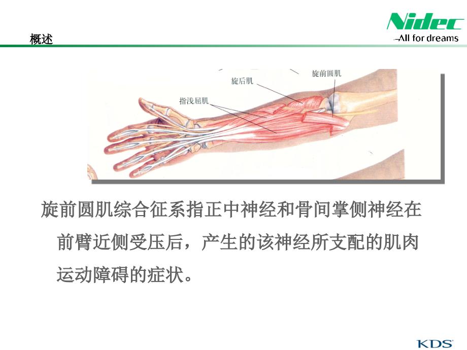 旋前圆肌综合症(精)_第3页