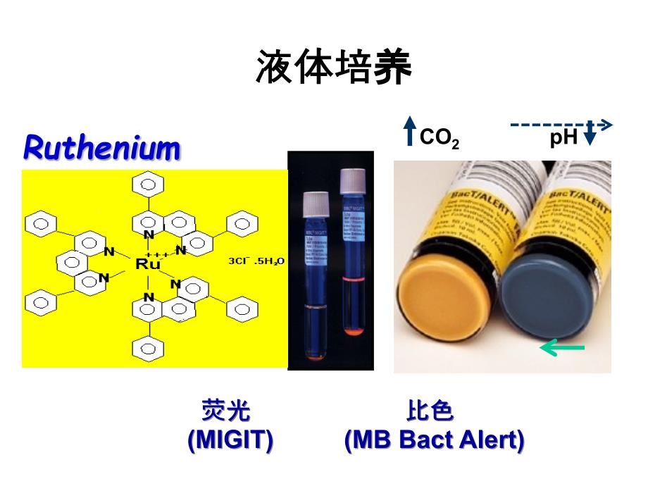 肺结核的新诊断技术.ppt_第4页