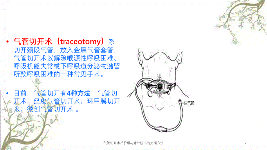 气管切开术后护理与意外脱出的处理方法_第2页