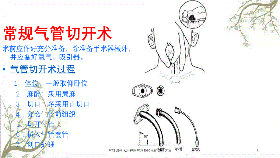 气管切开术后护理与意外脱出的处理方法_第3页