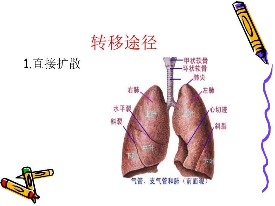 肺癌疾病病人的护理_第5页