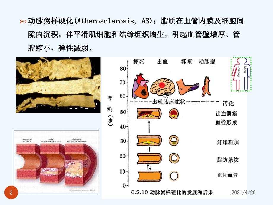 调血脂药及抗动脉粥样硬化药_第2页