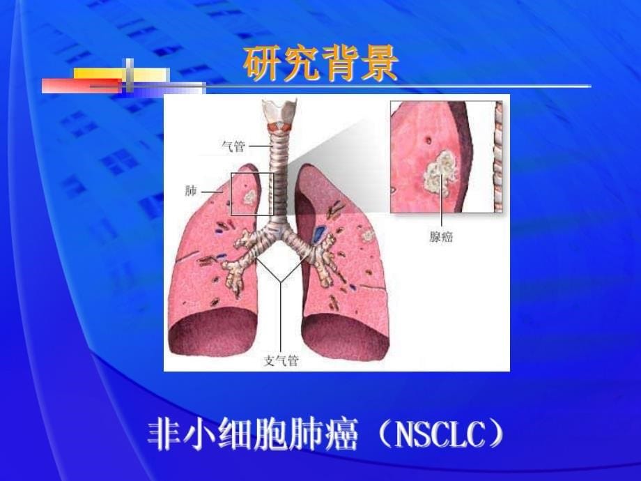 医学研究生开题报告.ppt_第5页