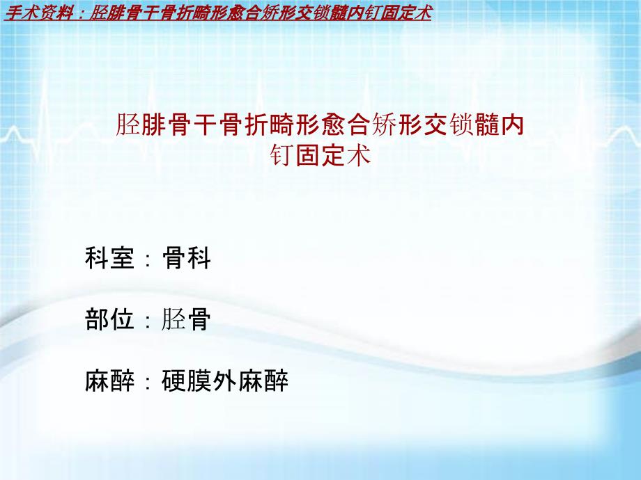 外科手术教学资料：胫腓骨干骨折畸形愈合矫形交锁髓内钉固定术讲解模板_第2页