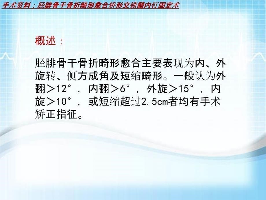 外科手术教学资料：胫腓骨干骨折畸形愈合矫形交锁髓内钉固定术讲解模板_第5页