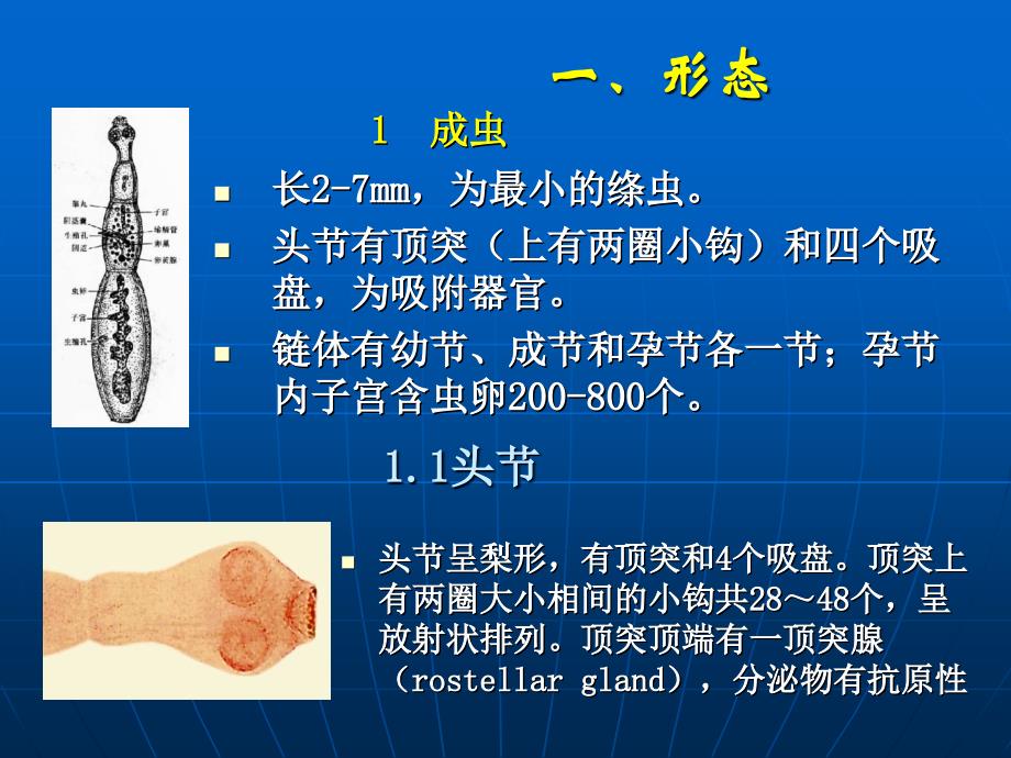 山东大学人体寄生虫学课件10细粒棘球绦虫_第4页