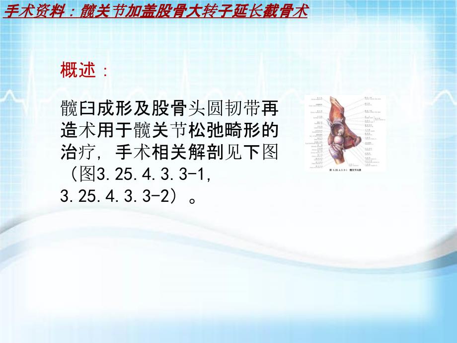 外科手术教学资料：髋关节加盖股骨大转子延长截骨术讲解模板_第3页