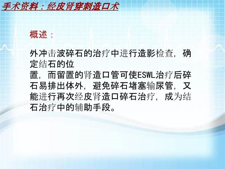 外科手术教学资料：经皮肾穿刺造口术讲解模板_第5页