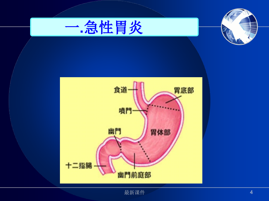 2第二节 胃炎病人的护理ppt课件_第4页