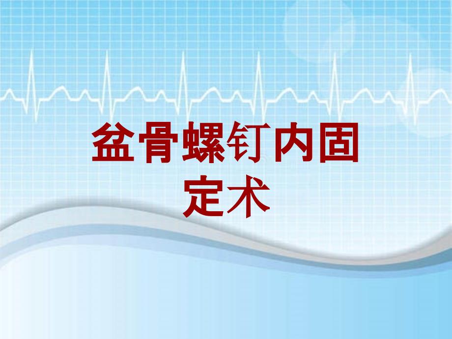 外科手术教学资料：盆骨螺钉内固定术讲解模板_第1页