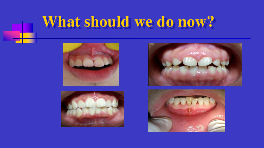 山东大学牙周病学课件15牙周病的手术治疗_第4页