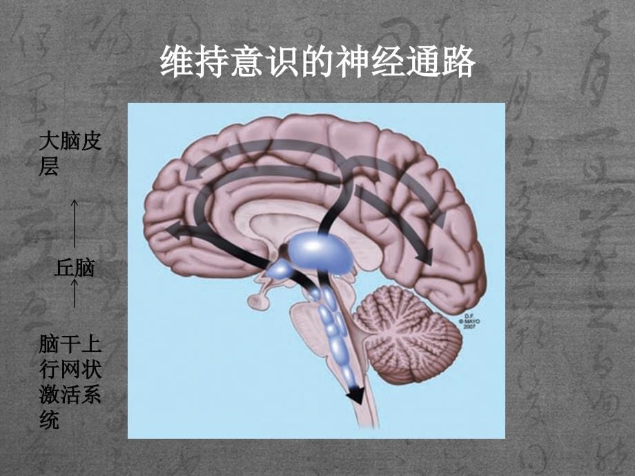 卫生人员培训-昏迷--张乐 湘雅医院神经内科_第5页