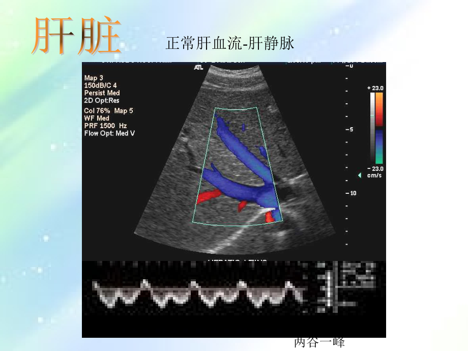 常见病B超图谱-PPT课件_第3页