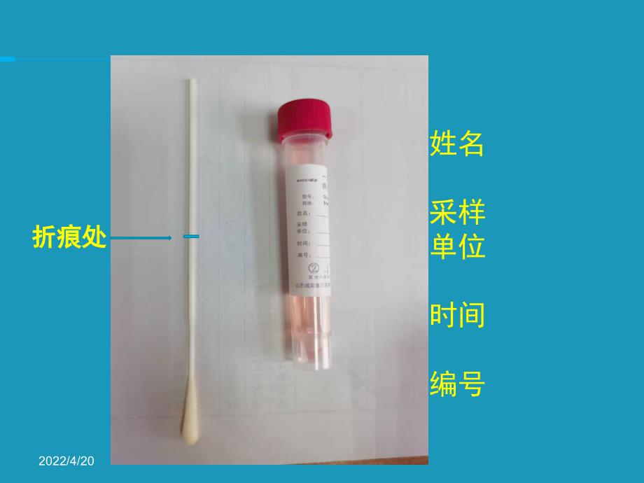 新冠咽拭子采集_第4页