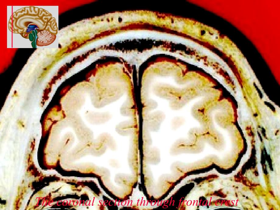 山东大学断层解剖学双语课件11头颅冠状面与MRI_第2页