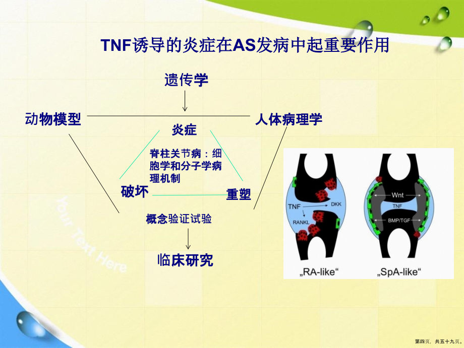 脊柱关节炎诊断及治疗进展2讲课文档_第4页