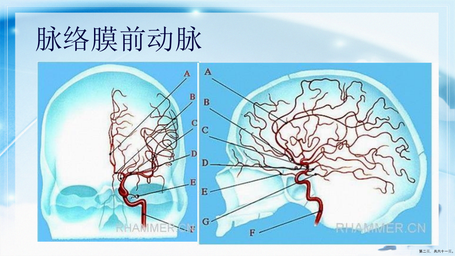 脑动脉解剖及临床脉络膜前动脉讲课文档_第2页