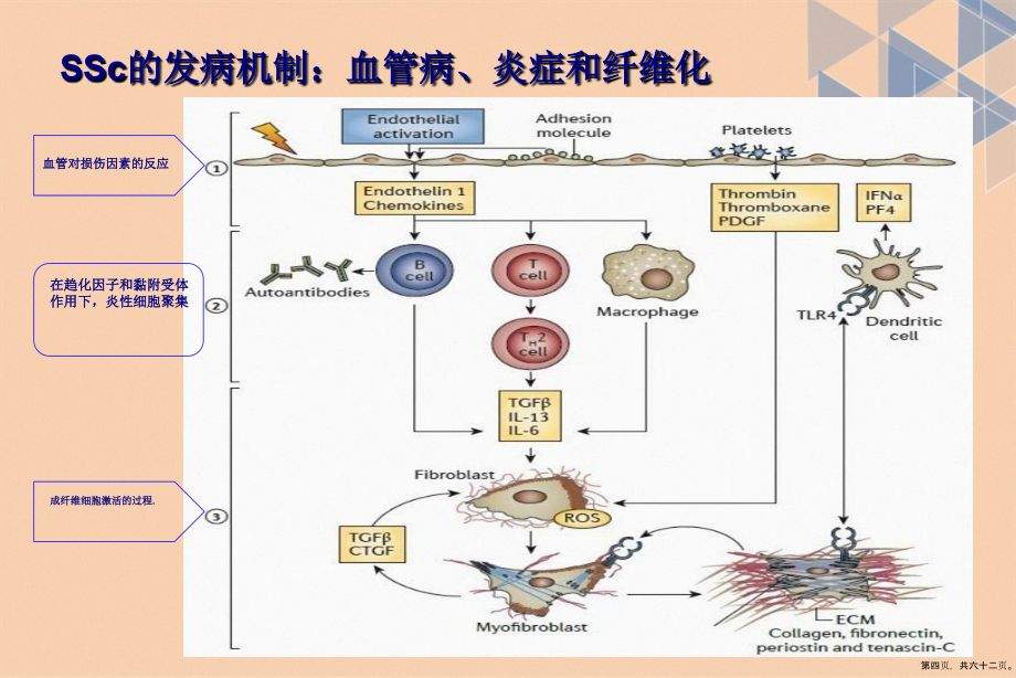 系统系硬化症讲课文档_第4页