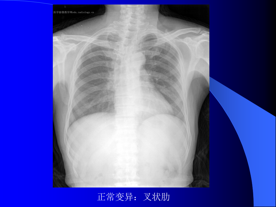 《正常与基本病变》PPT课件_第4页