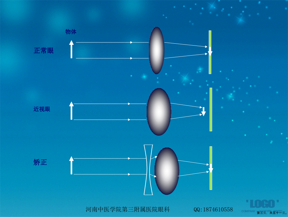 第四章预防近视眼冯磊讲课文档_第3页