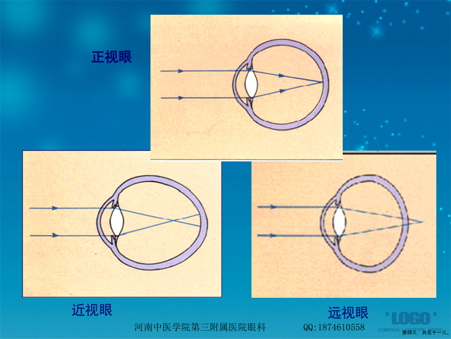 第四章预防近视眼冯磊讲课文档_第4页