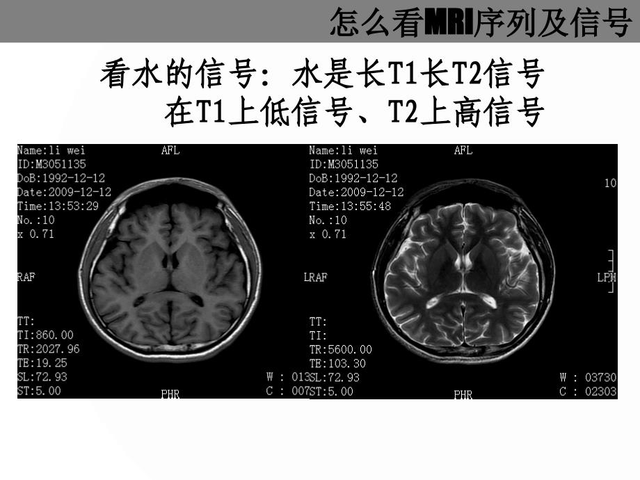 MRI诊断基础_第4页