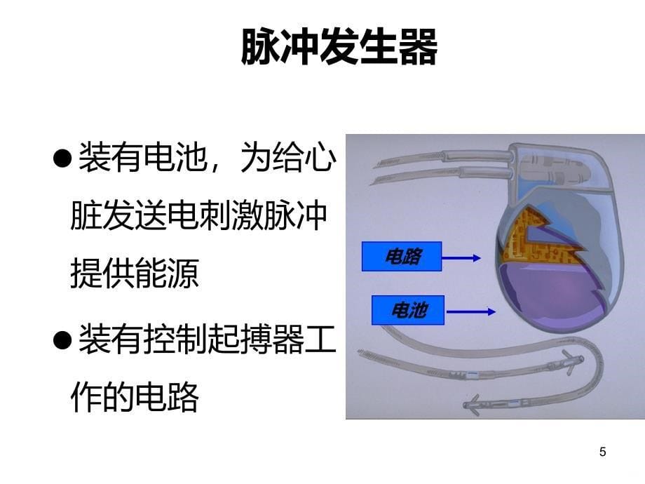 儿童永久心脏起搏器PPT课件_第5页