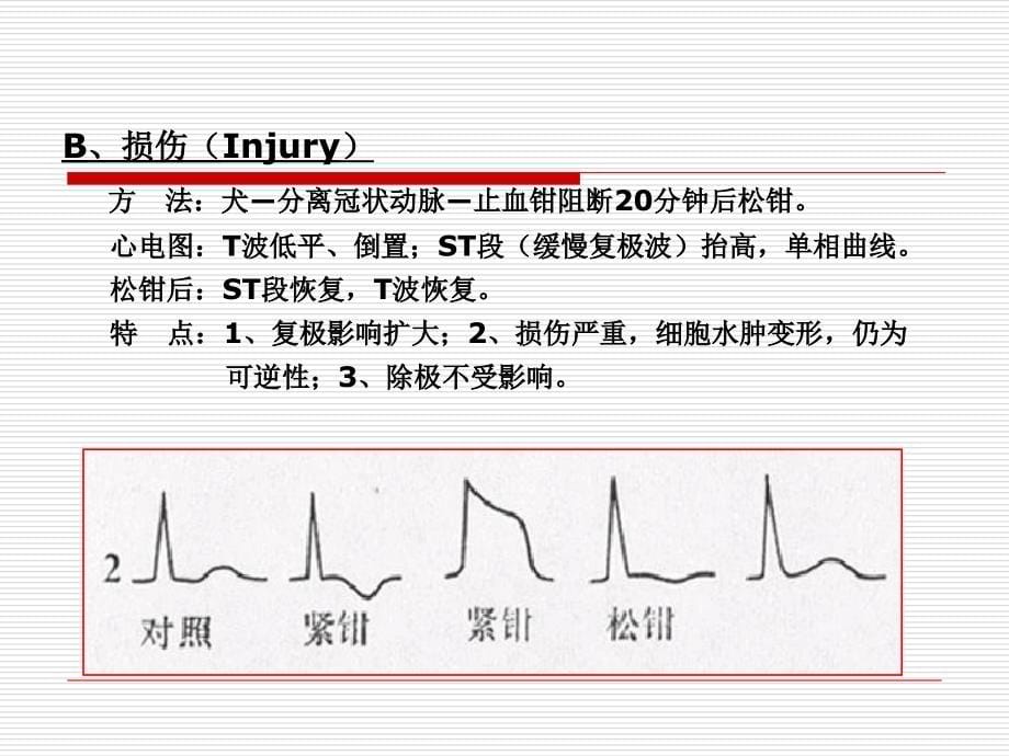 《冠心病专题》PPT课件_第5页