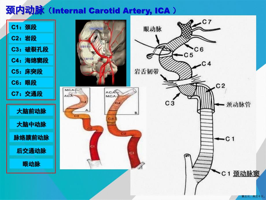 头颅血管脑动脉解剖与影像附加典型病例讲课文档_第3页
