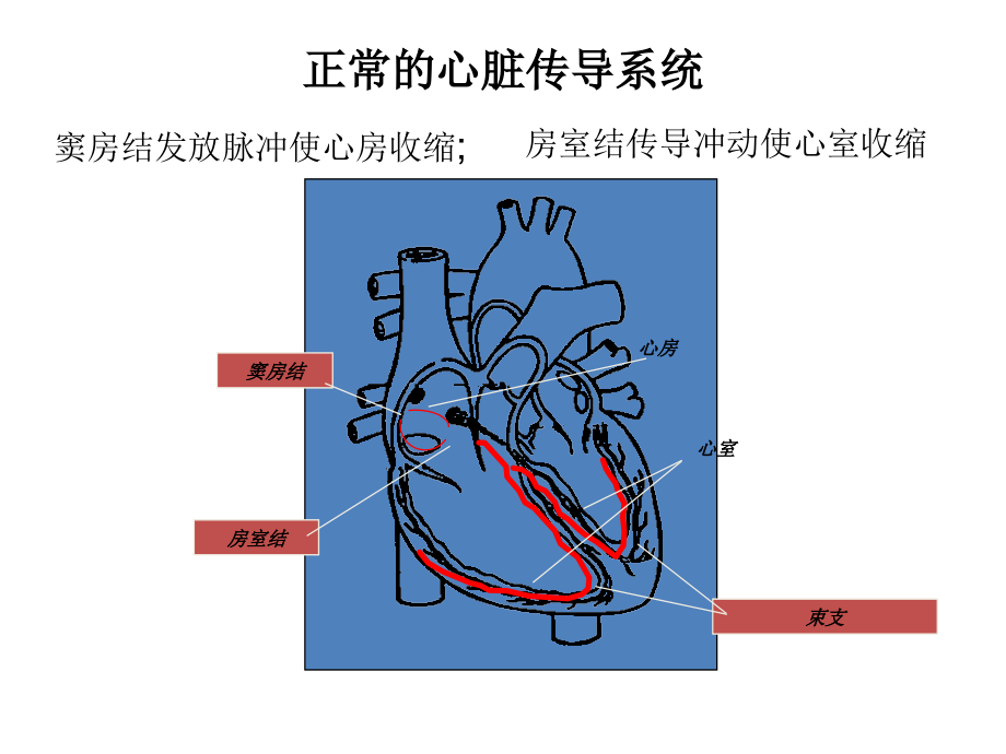 起搏器组成-和基础知识介绍ppt课件_第4页