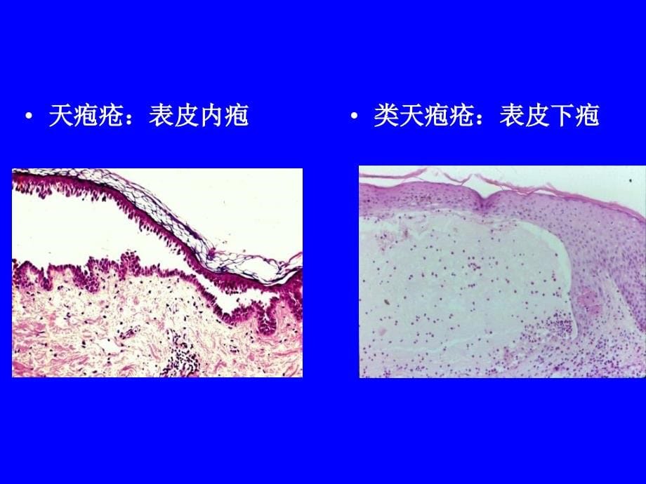 《大疱性皮肤病本》PPT课件_第5页