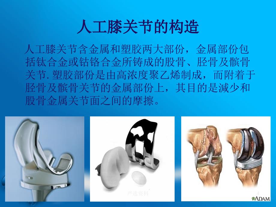 人工全膝关节置换术详细(医学材料)课件_第4页