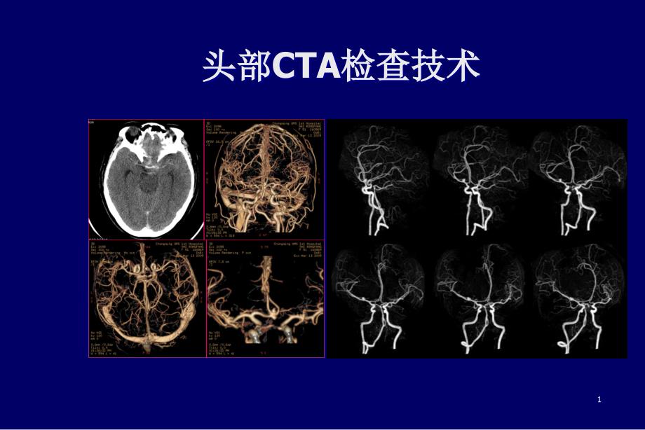 头部CTA检查技术课件_第1页