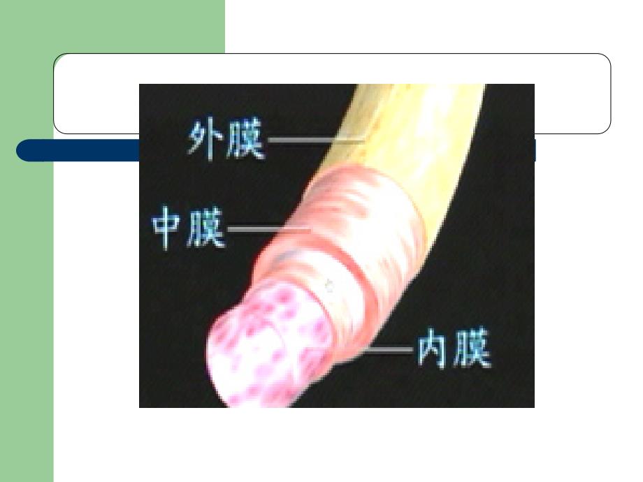 主动脉夹层69979_第3页