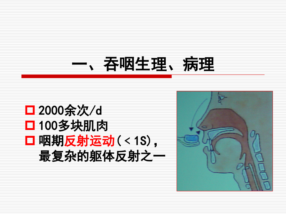 第七章-吞咽障碍课件_第4页