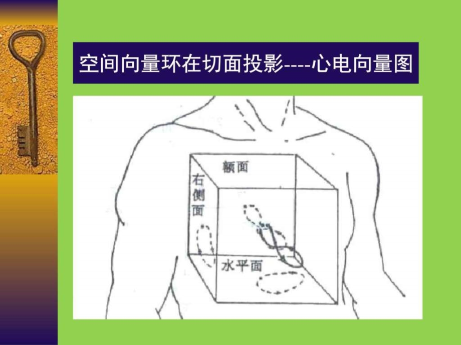 常见心电图诊断要点_临床医学_医药卫生_第2页