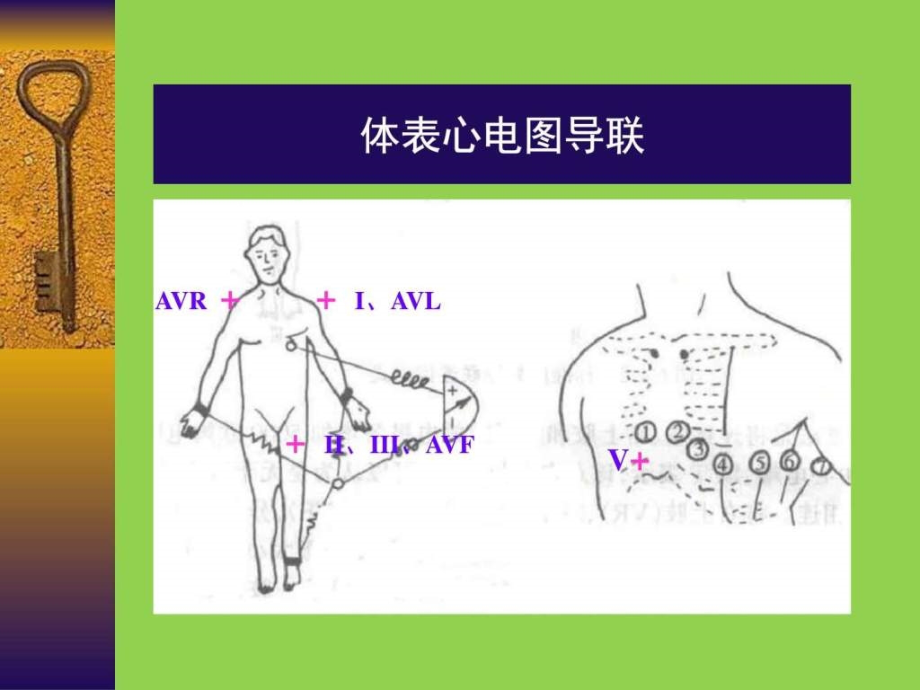 常见心电图诊断要点_临床医学_医药卫生_第4页