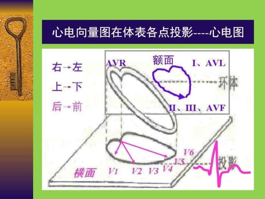 常见心电图诊断要点_临床医学_医药卫生_第5页