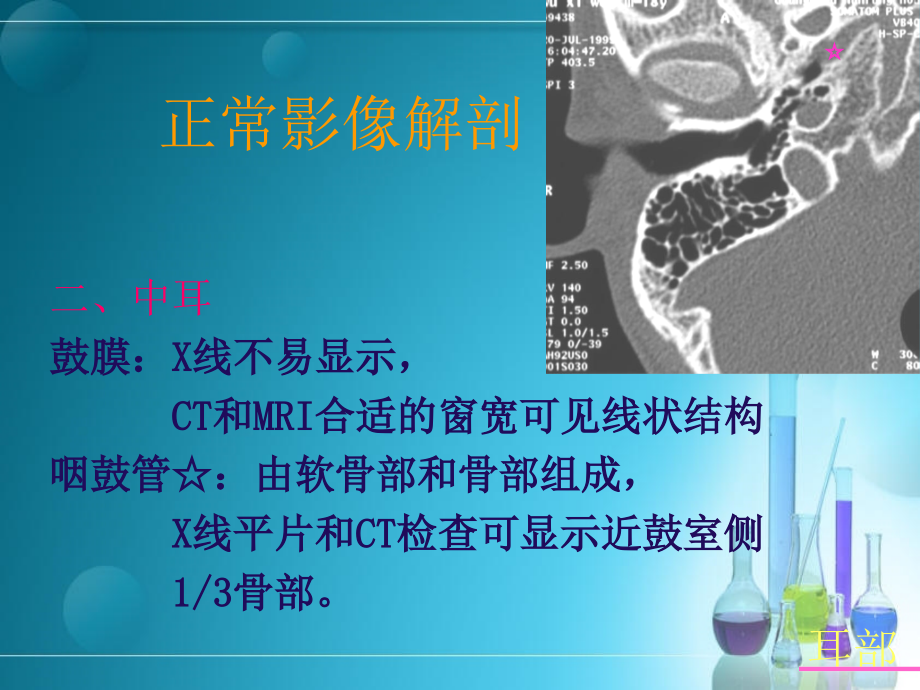 耳部解剖及常见疾病诊断课件_第4页