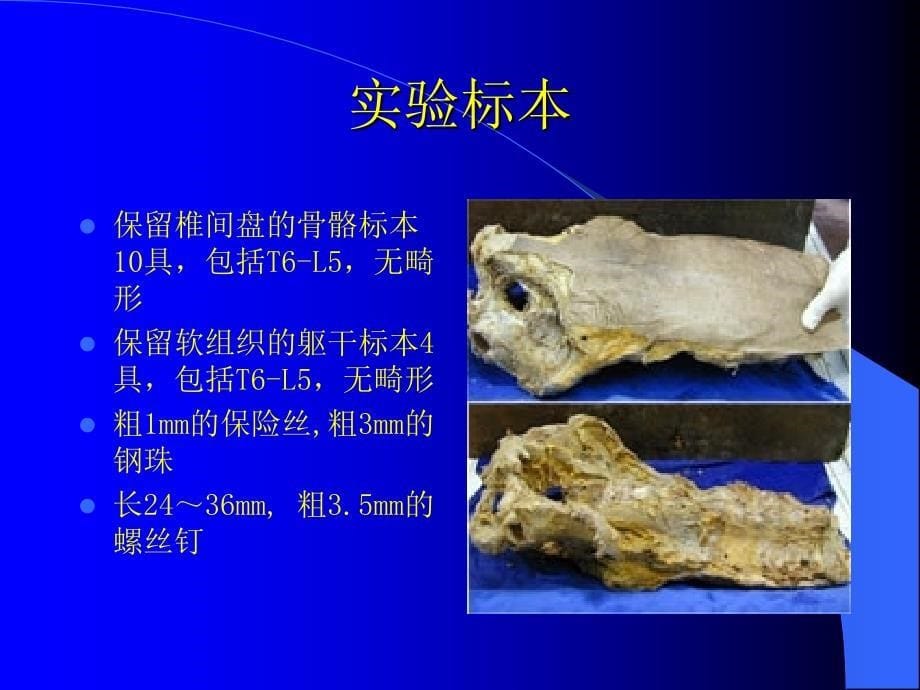 经椎弓根胸腰椎内固定进针方法研究进展课件_第5页