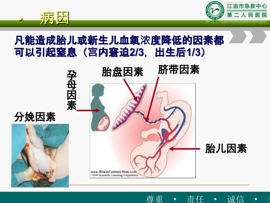 新生儿窒息第七版教材资料课件_第3页