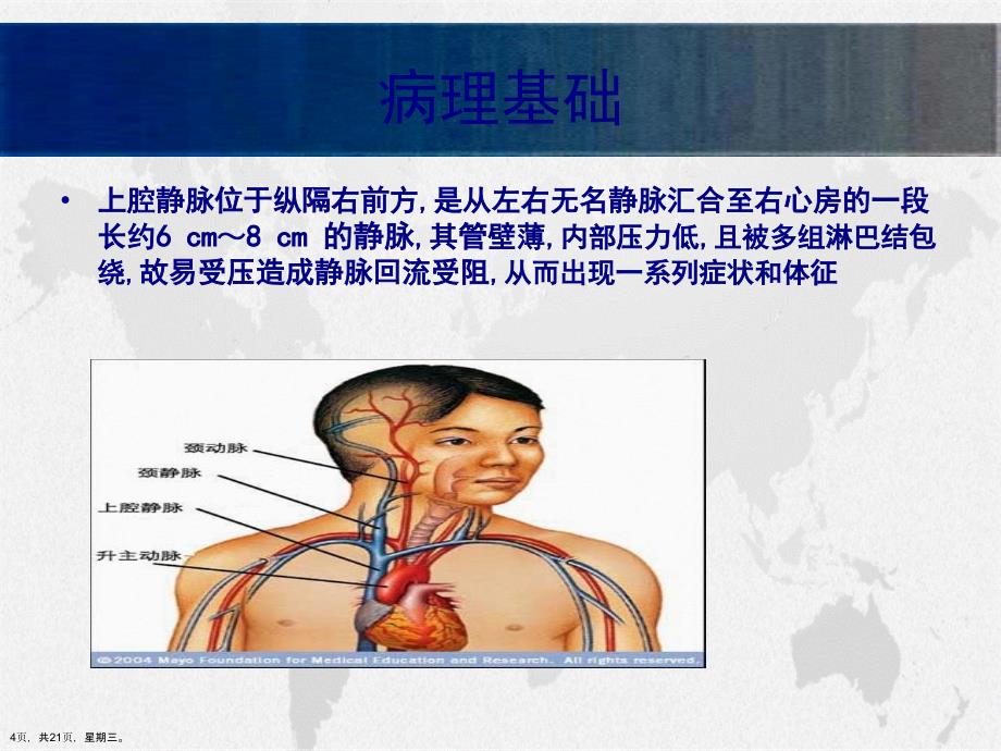 上腔静脉综合征的护理演示文稿_第4页