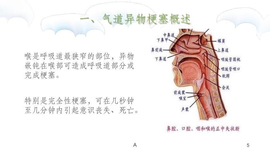 气道异物梗阻课件_第5页