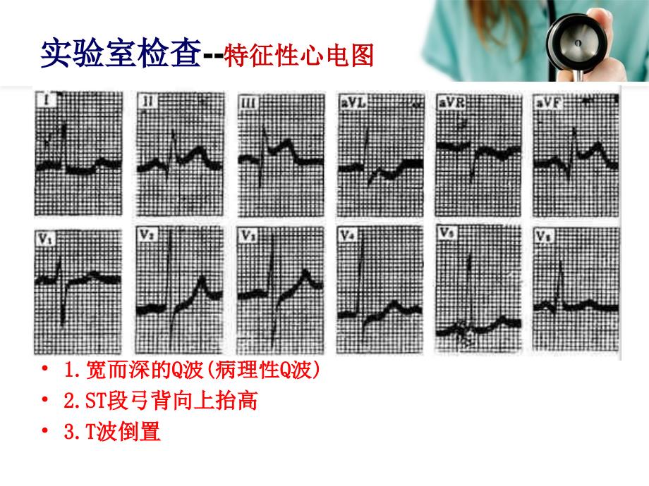 急性心梗患者个案查房课件_第4页