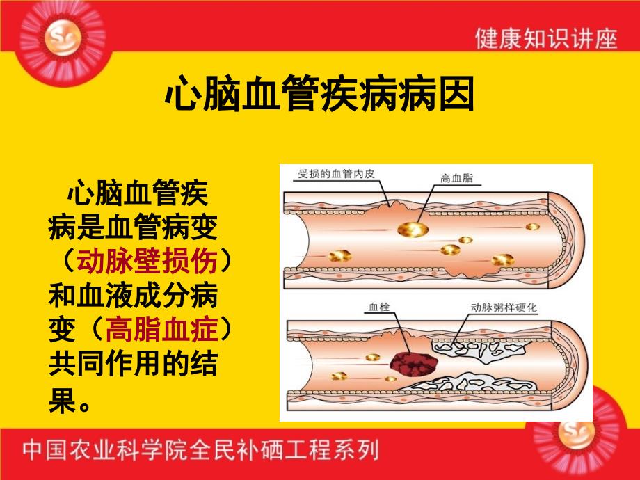 硒与健康-课件_第4页