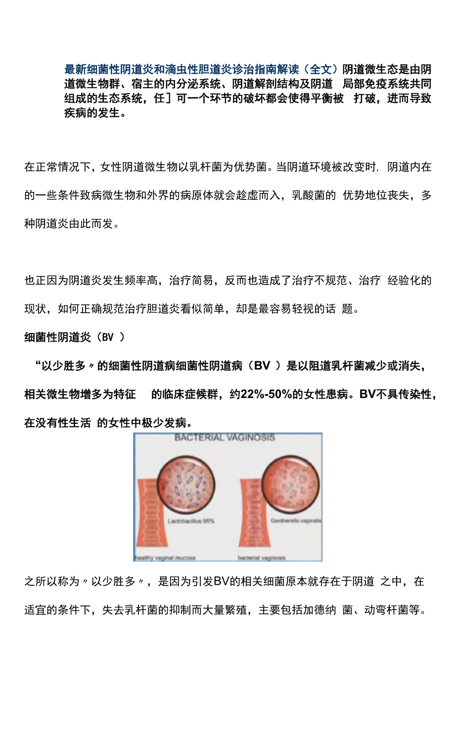 最新细菌性阴道炎和滴虫性阴道炎诊治指南解读（全文）_第1页