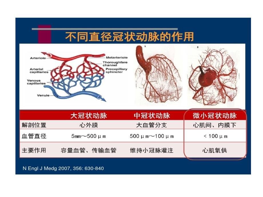 冠状动脉微血管病变与对策课件_第5页