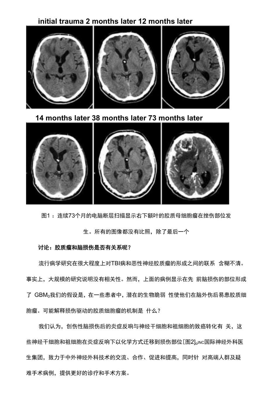 创伤性脑损伤和随后的胶质母细胞瘤发展_第5页