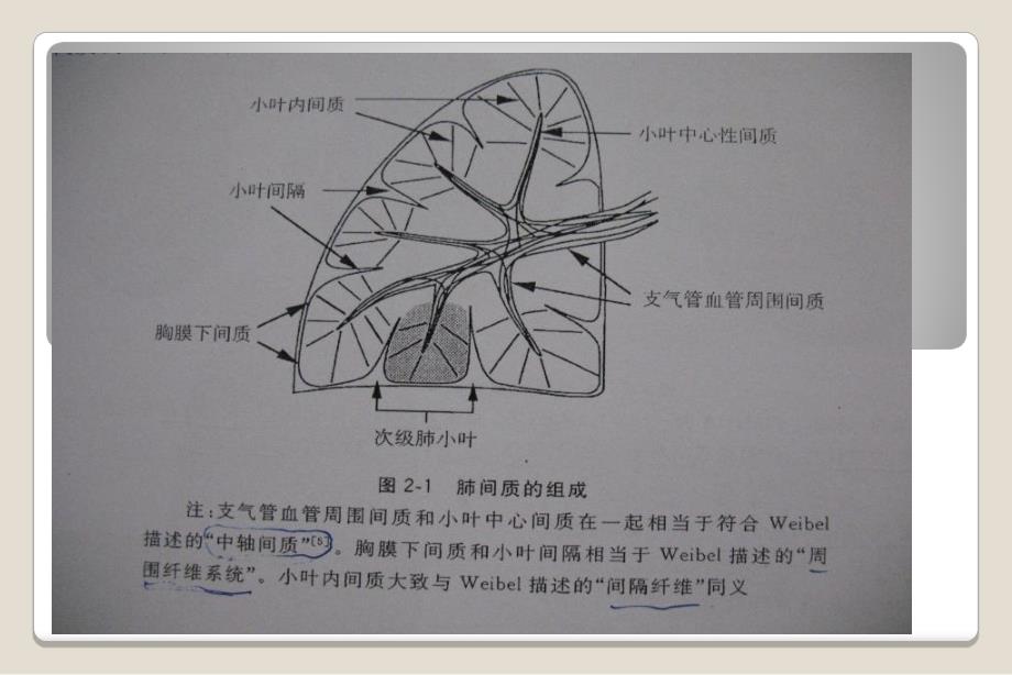 《肺特殊ct征象》PPT课件_第3页