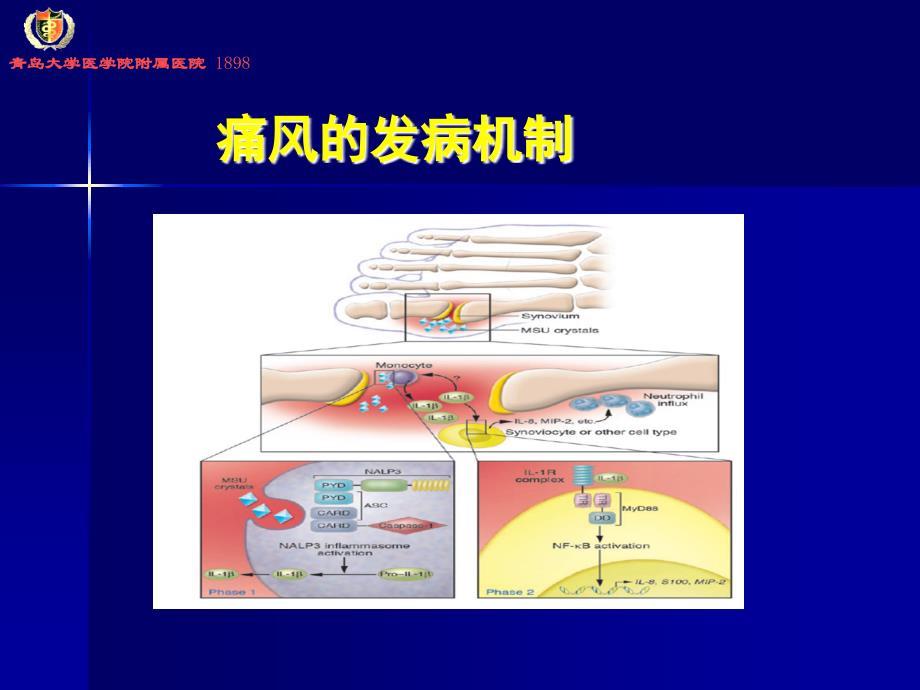 《痛风讲座》PPT课件_第3页